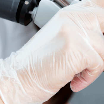 Laser hair removal